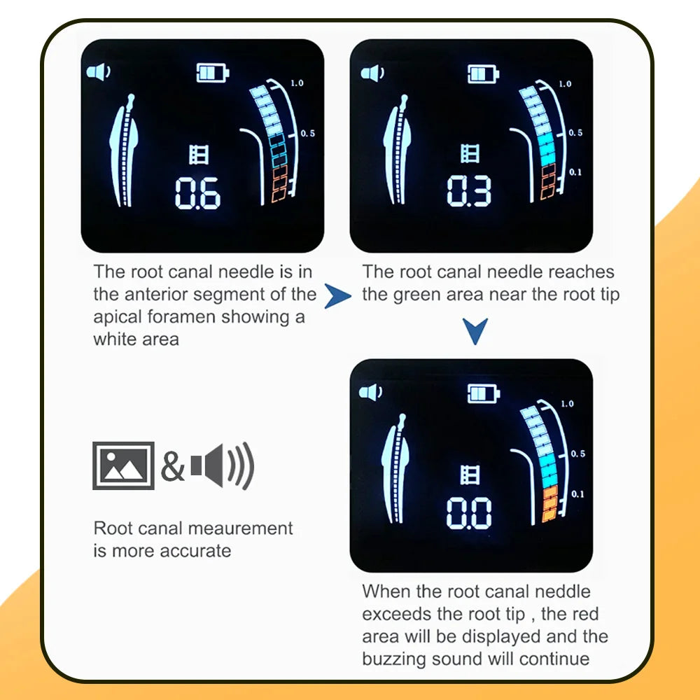 EXP Dental Endo Apex Locator Dentistry Endodontics Root Canal Measurement Mini Root Canal Located Instruments Dentistry Tool